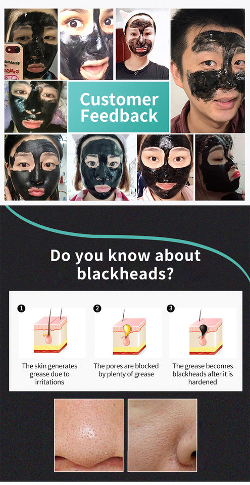 Korea Nose Blackhead Remover