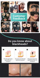 Korea Nose Blackhead Remover