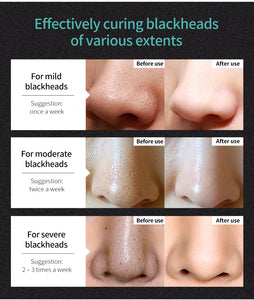 Korea Nose Blackhead Remover