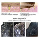 Korea Nose Blackhead Remover