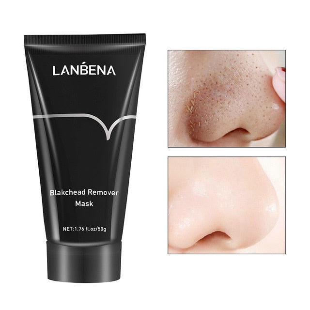 Korea Nose Blackhead Remover