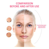 Nano Ionic Facial Steamer