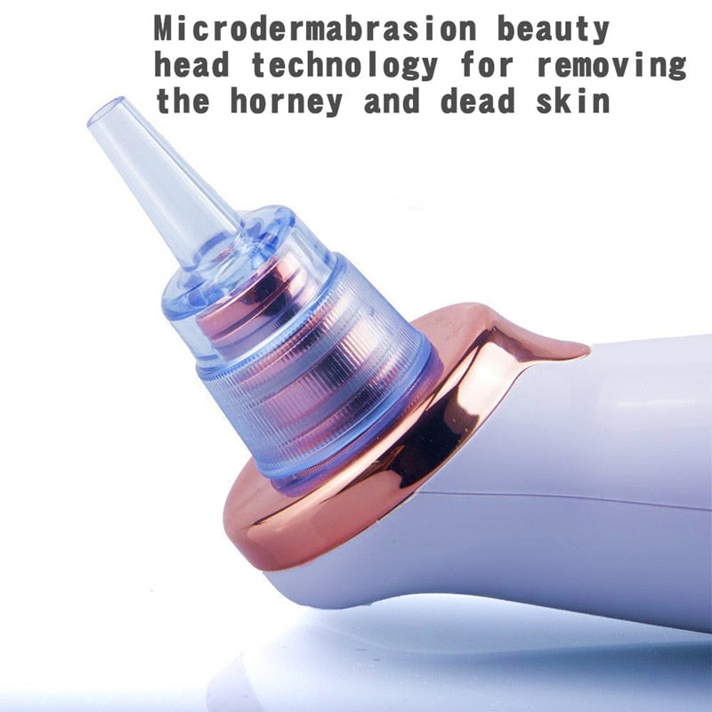 Facial Blackhead Remover