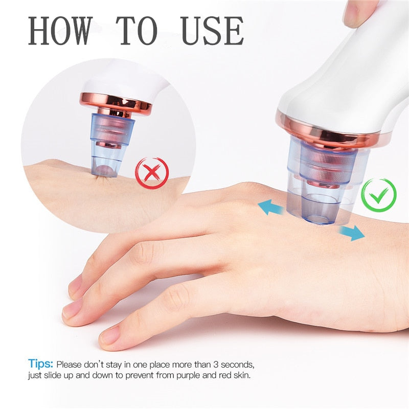 Facial Blackhead Remover